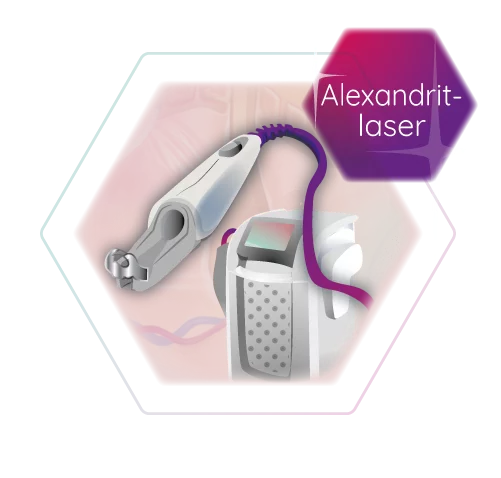 Grafik Alexandritlaser
