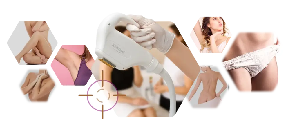 Kollage Körperregionen Behandlung dauerhafte Haarentfernung bei Frau